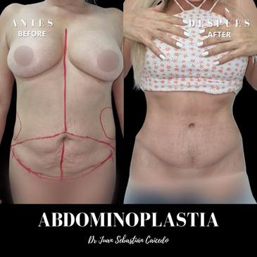 Slider image (4) Dr. Juan Sebastian Caicedo